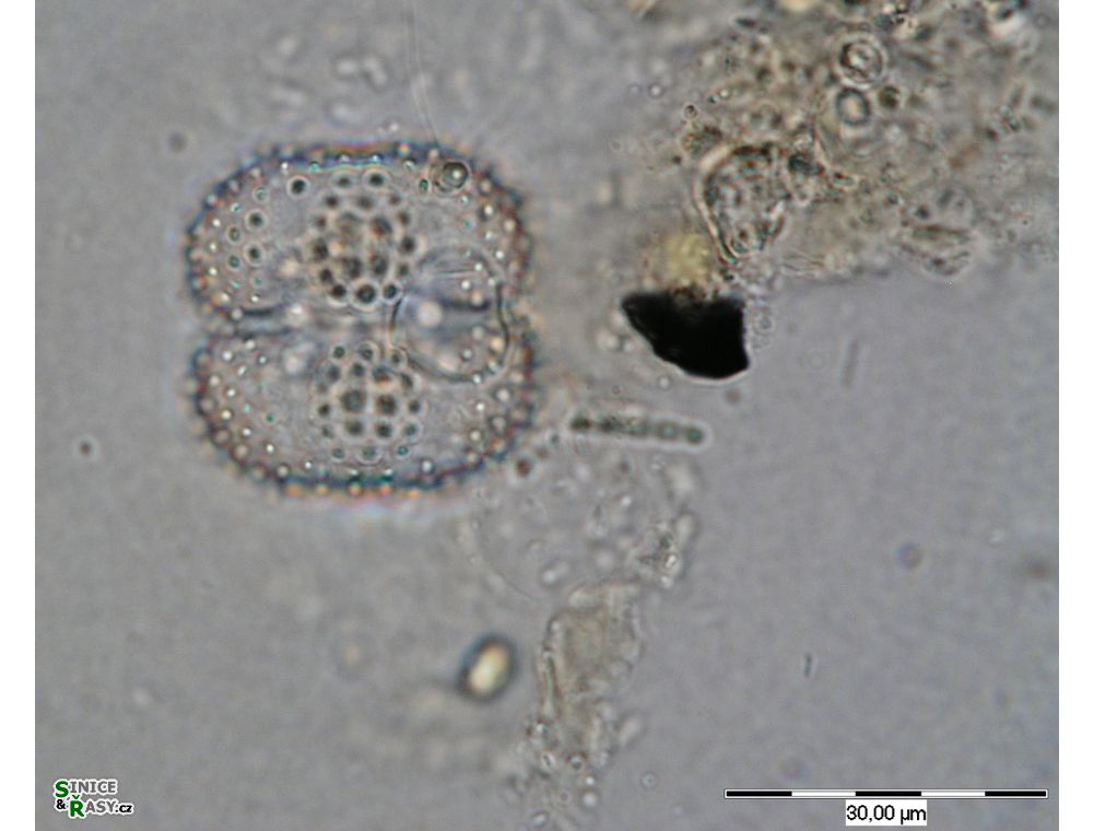 Cosmarium pseudoornatum