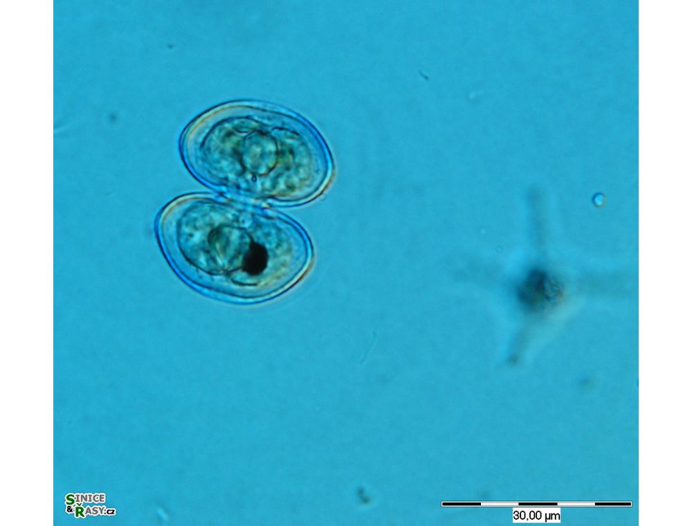 Cosmarium pseudoprotuberans