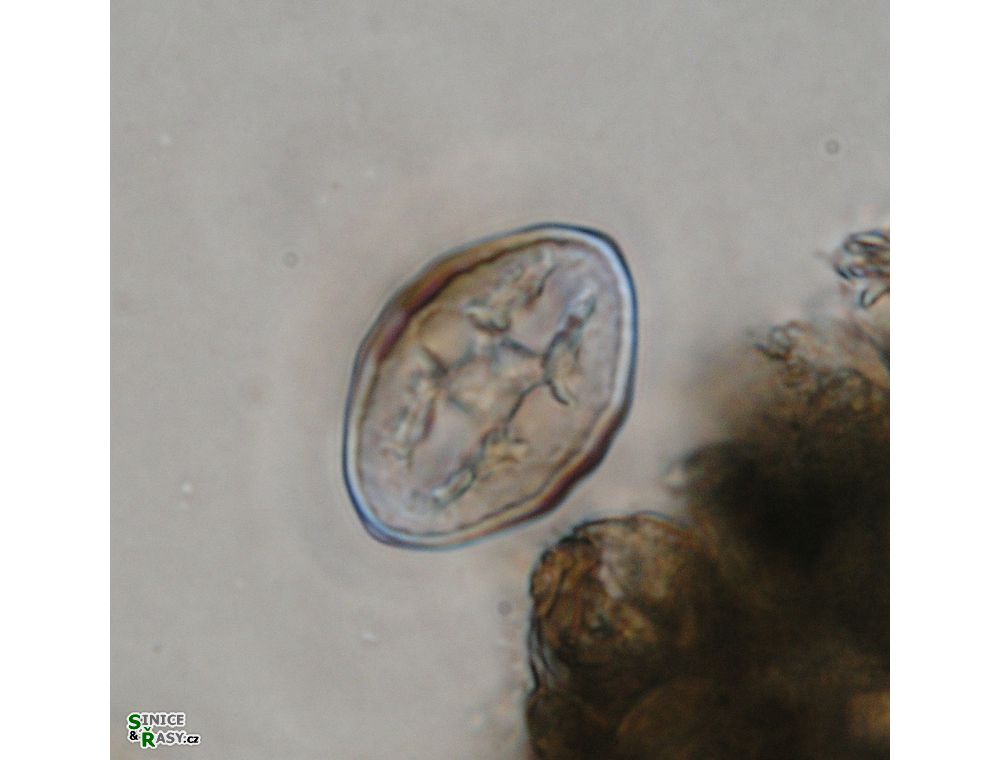 Cosmarium pseudoprotuberans