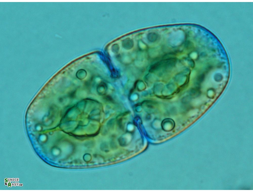 Cosmarium pseudopyramidatum