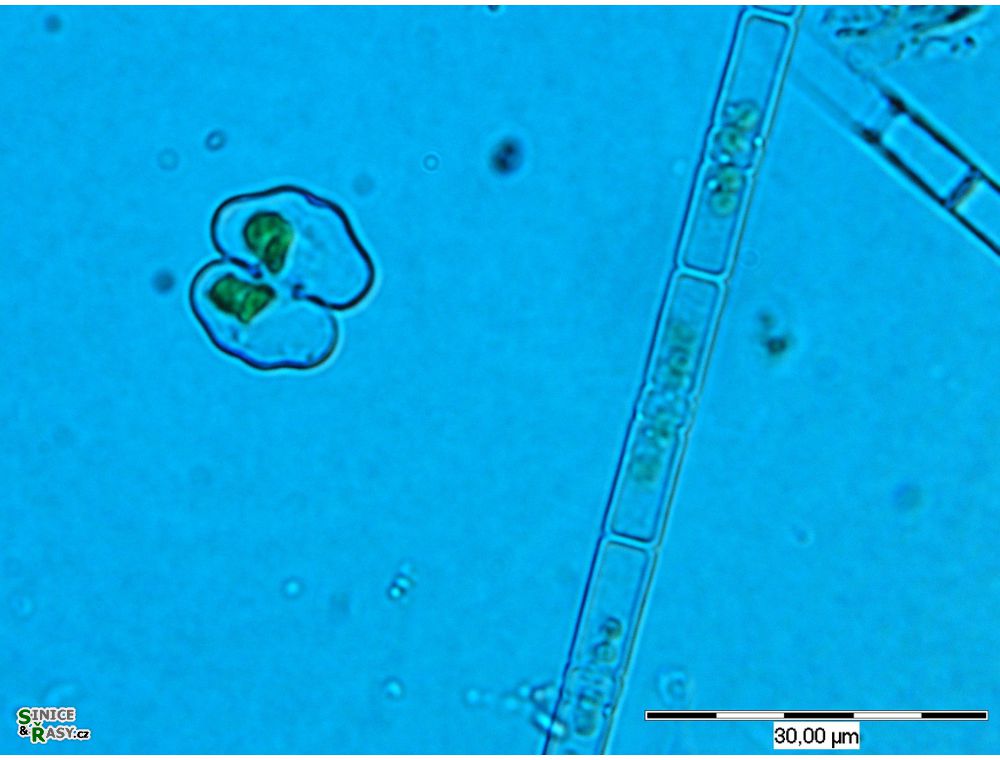 Cosmarium pseudowembaerense