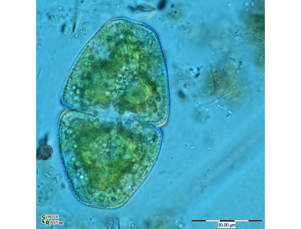 Cosmarium pyramidatum