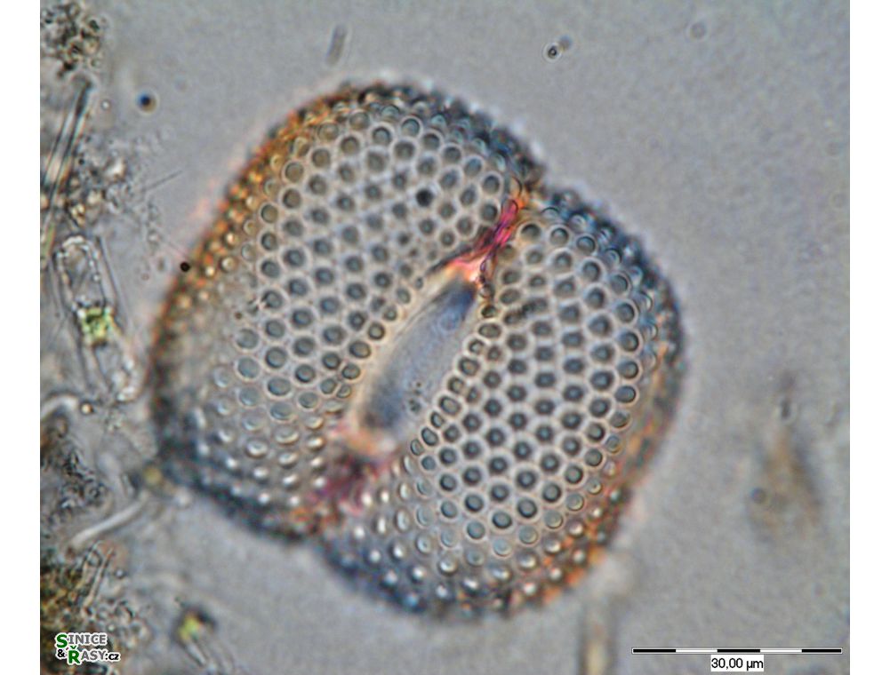 Cosmarium quadrum