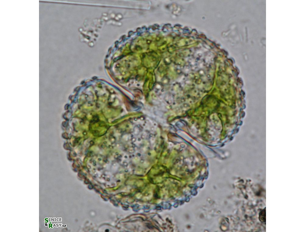 Cosmarium reniforme