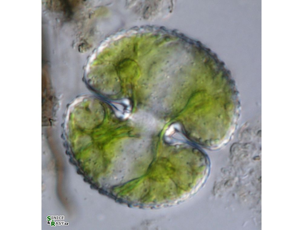 Cosmarium reniforme