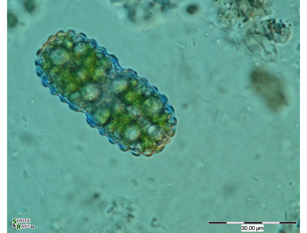 Cosmarium simplicius