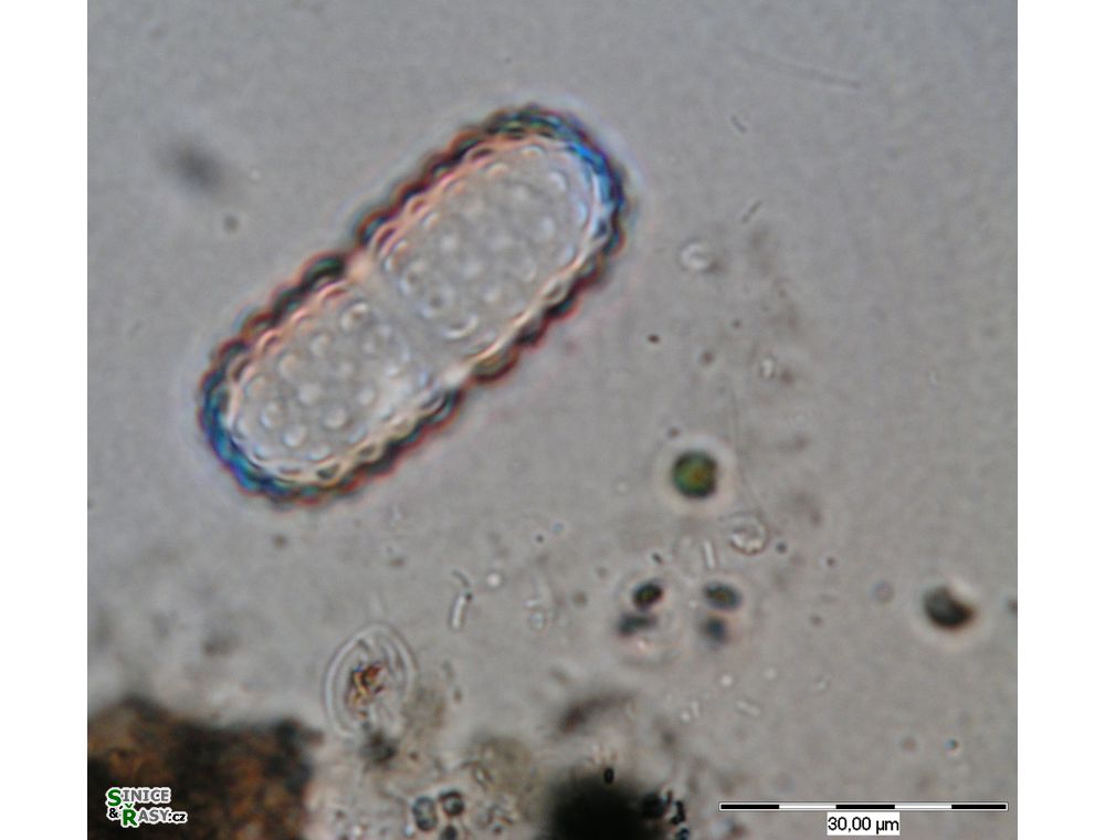 Cosmarium simplicius