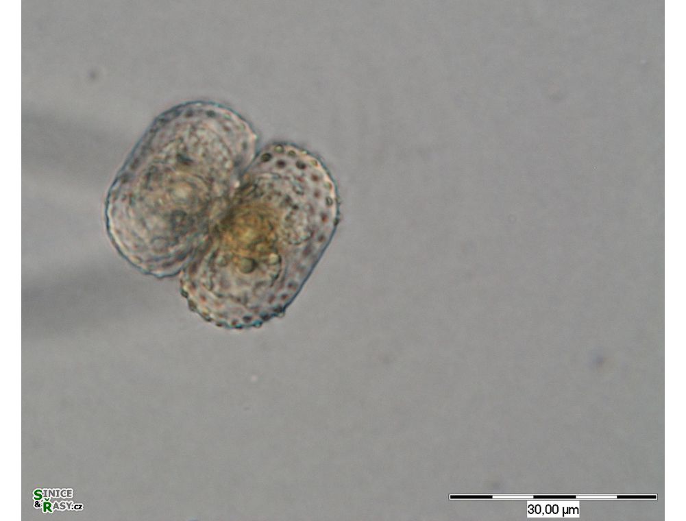 Cosmarium
