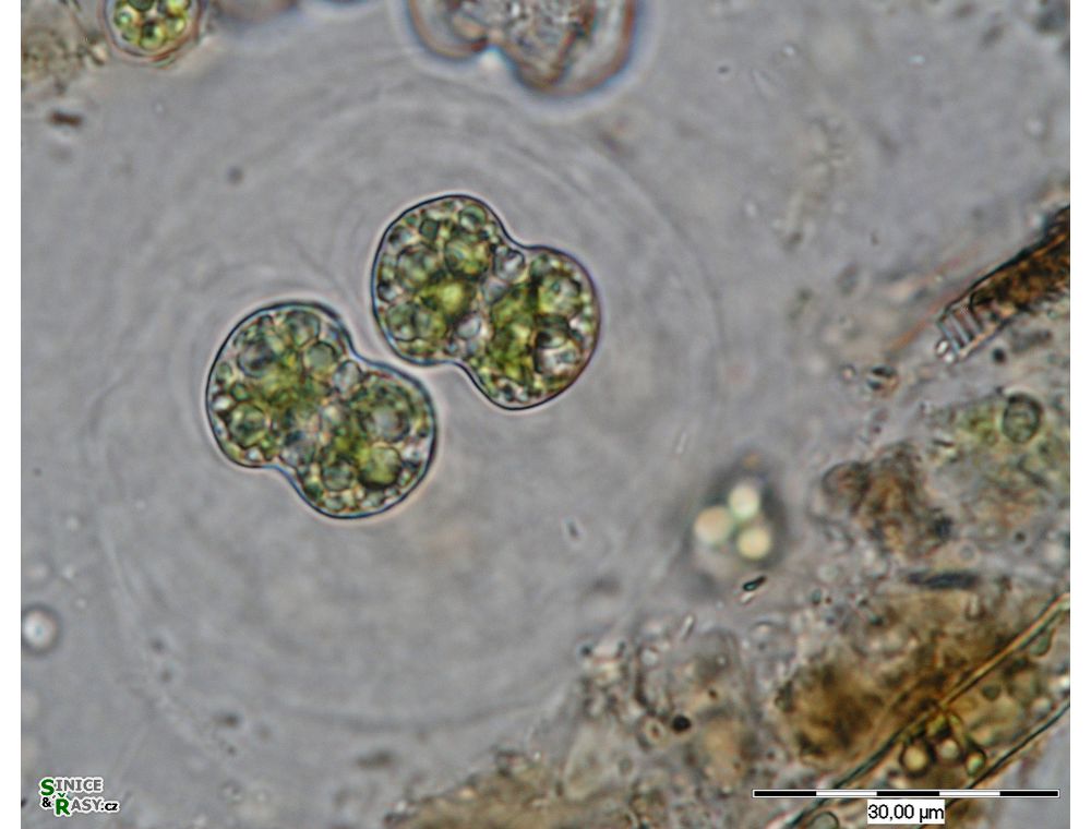 Cosmarium