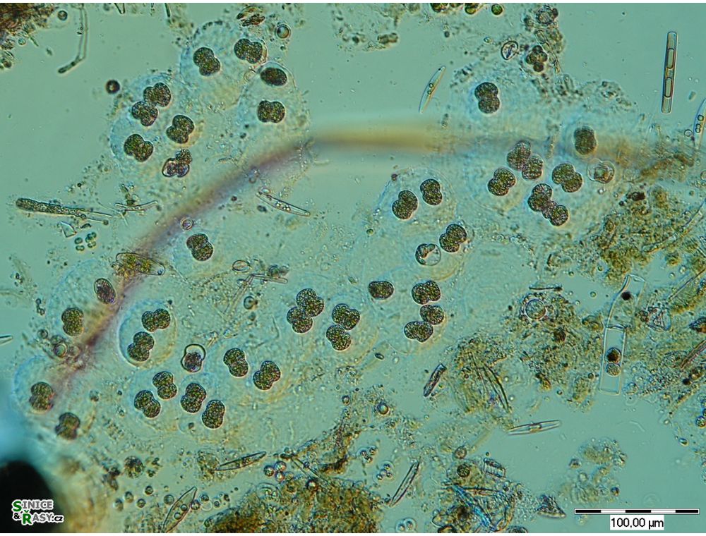 Cosmarium