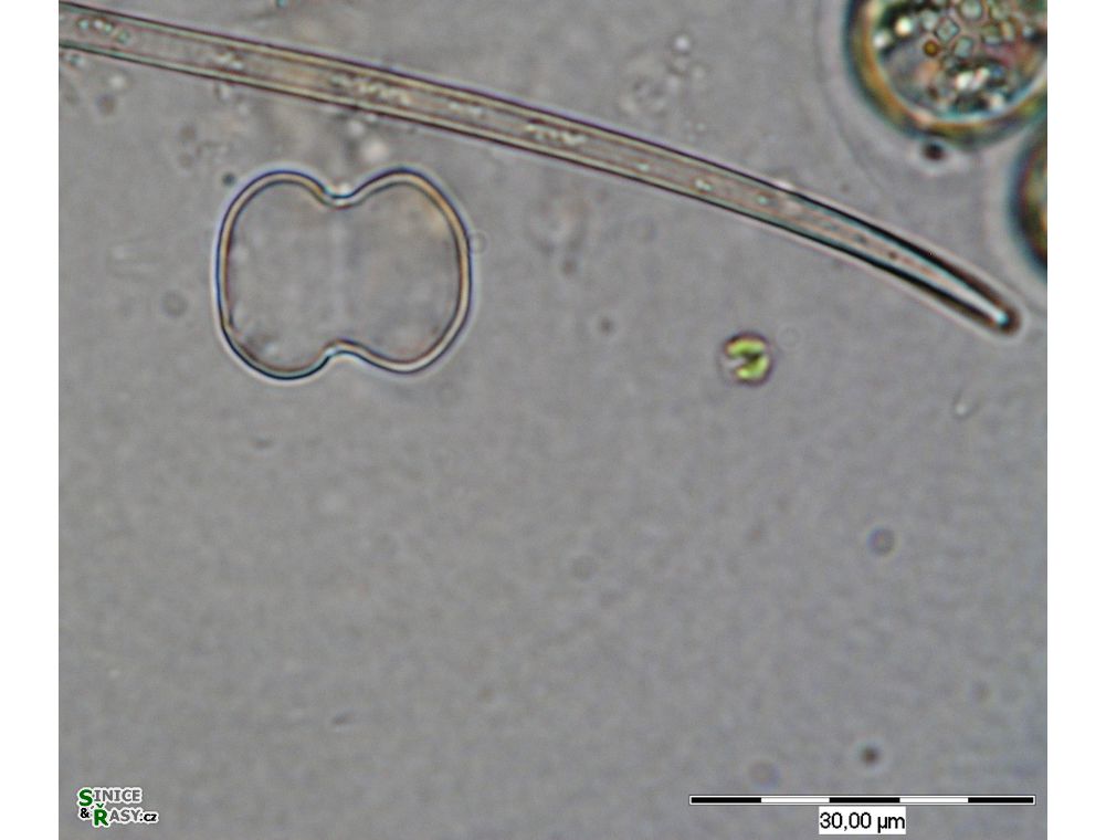 Cosmarium