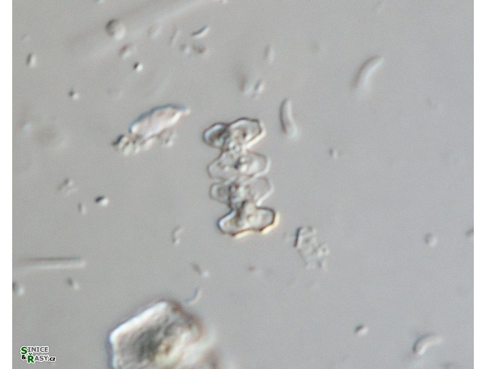 Cosmarium