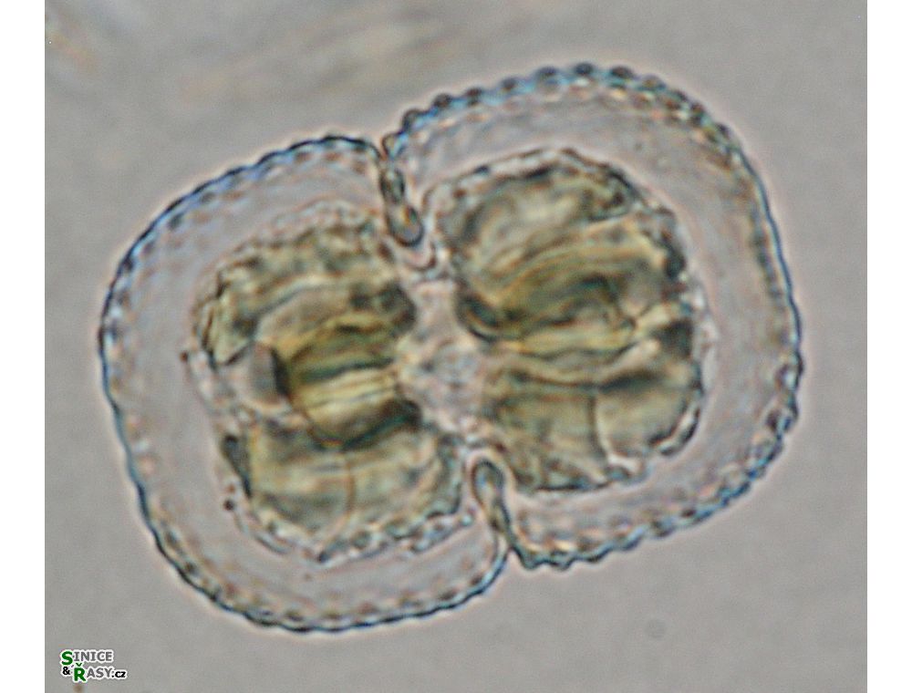 Cosmarium