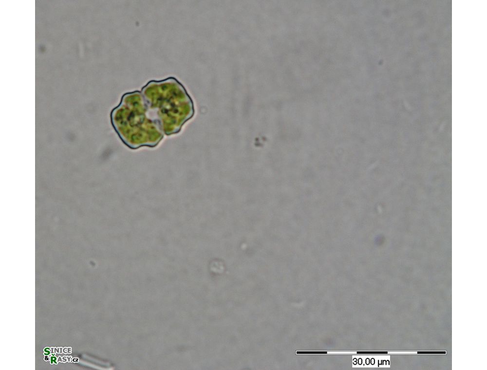 Cosmarium sphyrelatum