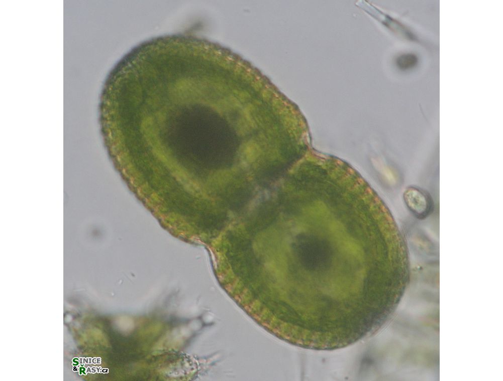 Cosmarium striolatum