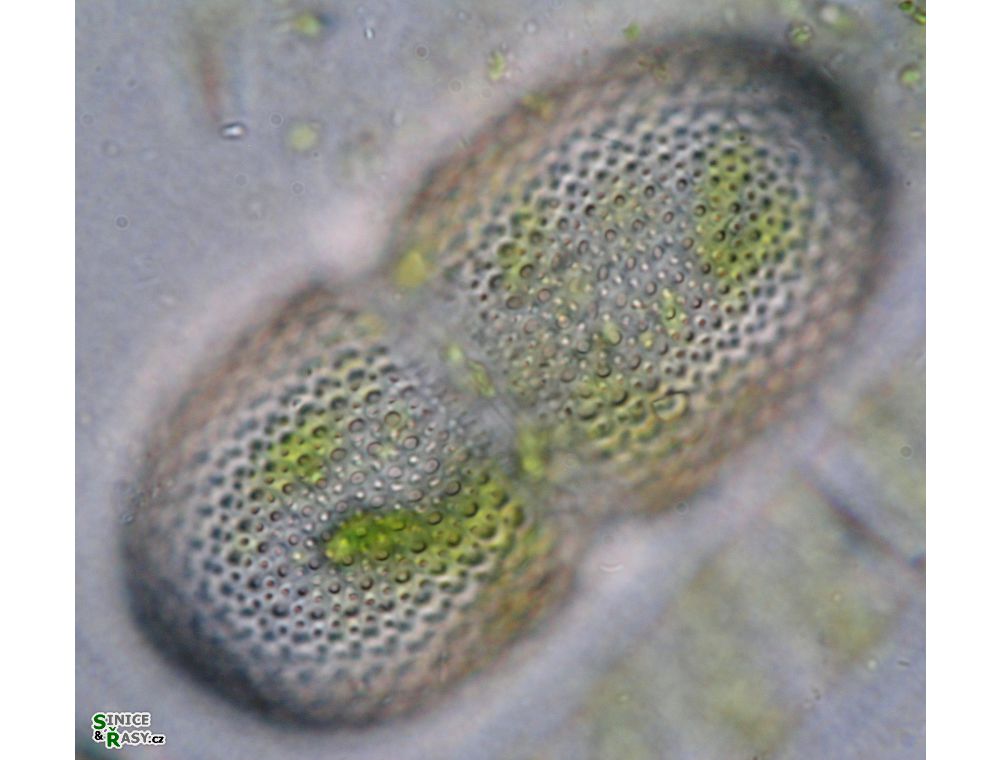 Cosmarium striolatum