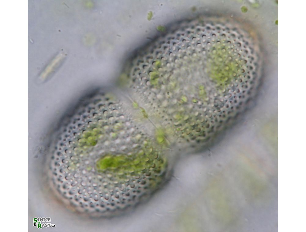 Cosmarium striolatum