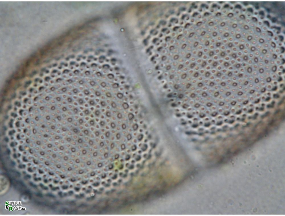 Cosmarium striolatum