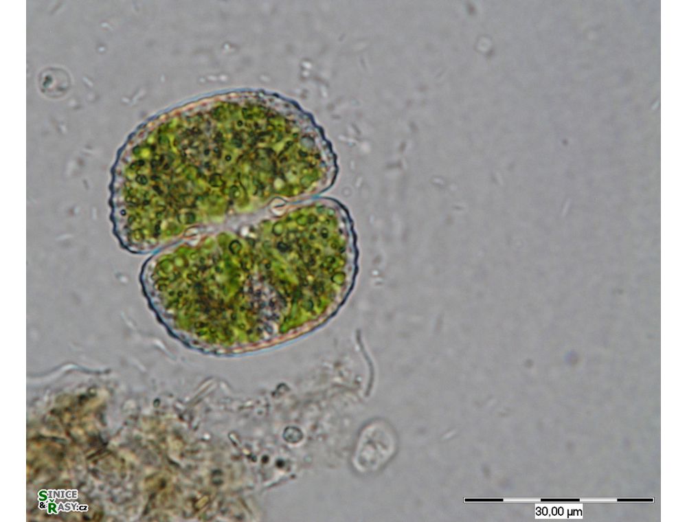 Cosmarium subbroomei