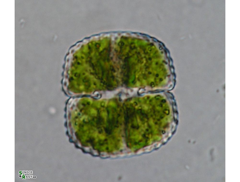Cosmarium subbroomei