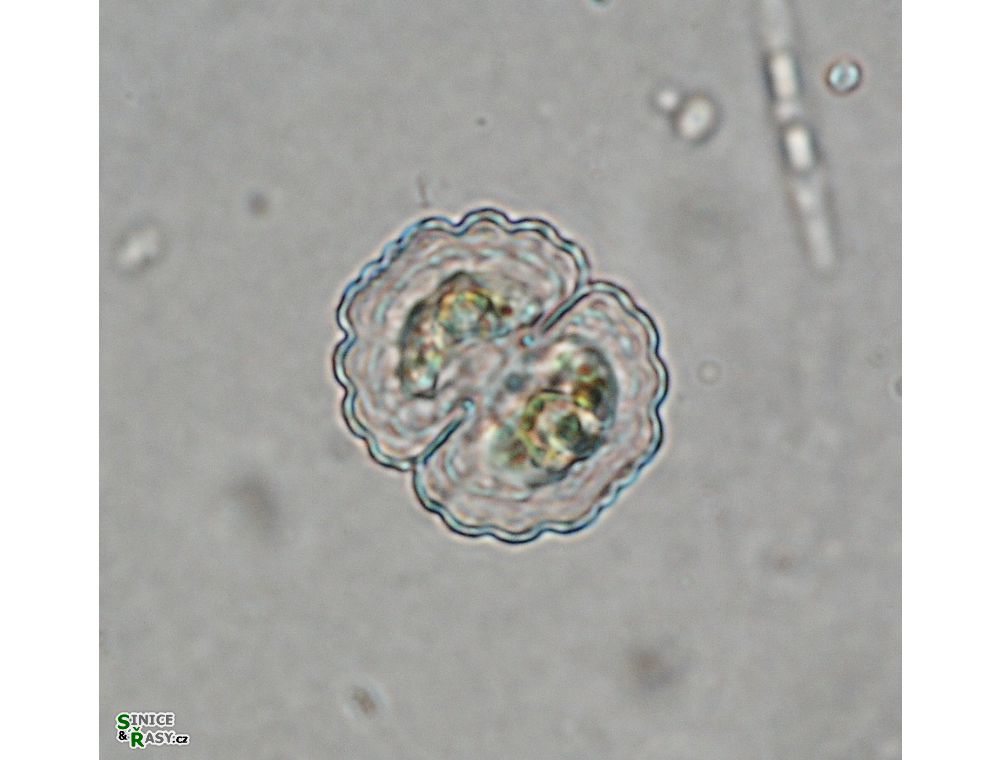 Cosmarium subprotumidum