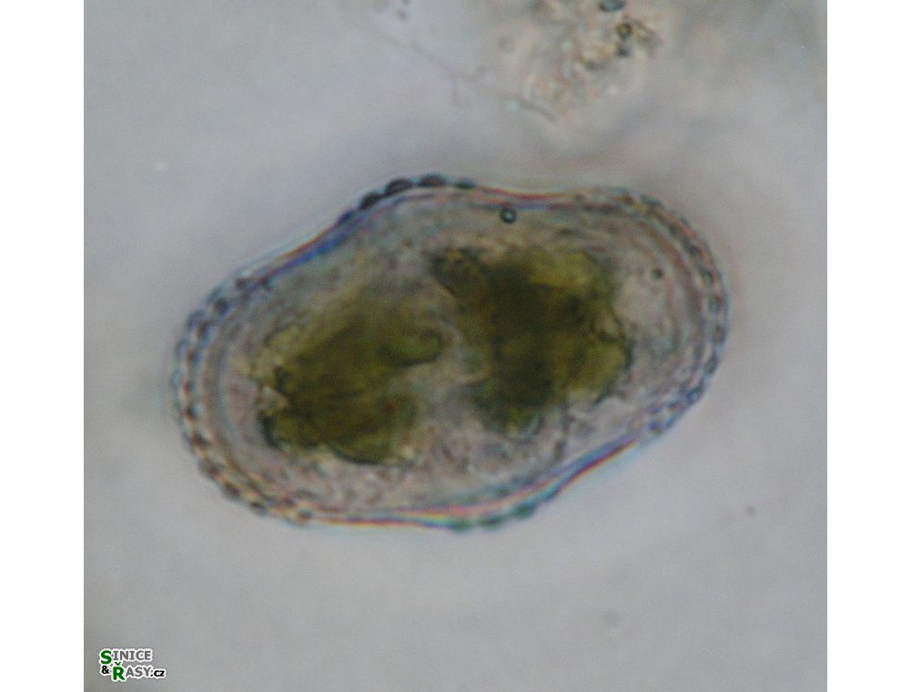 Cosmarium subspeciosum
