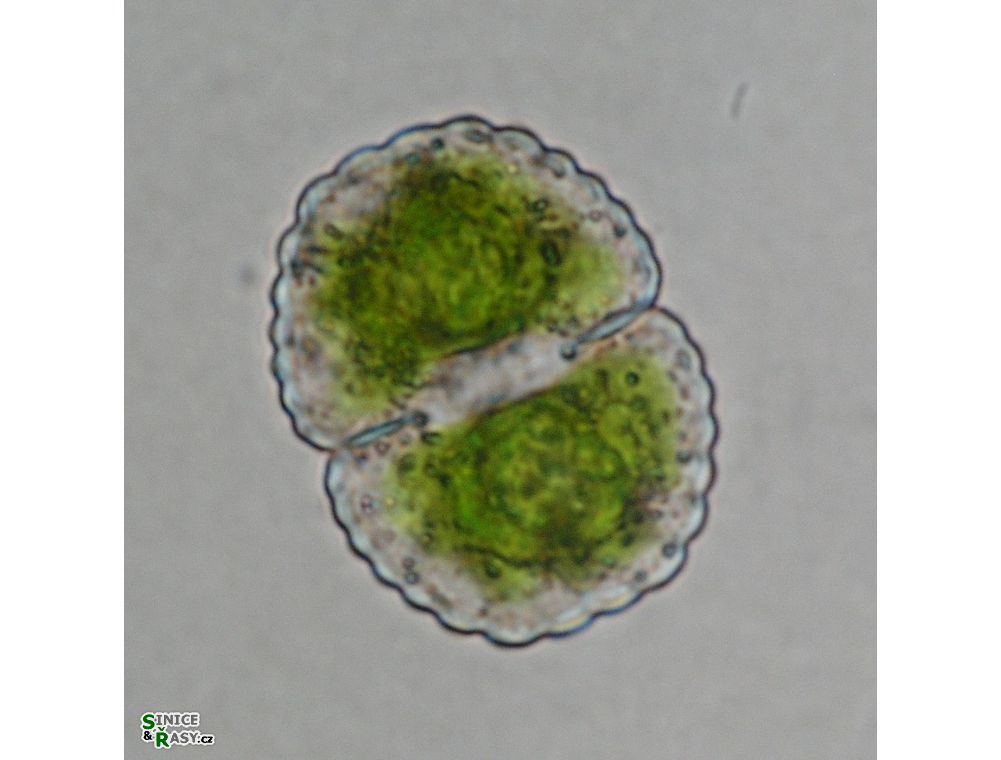 Cosmarium subspeciosum
