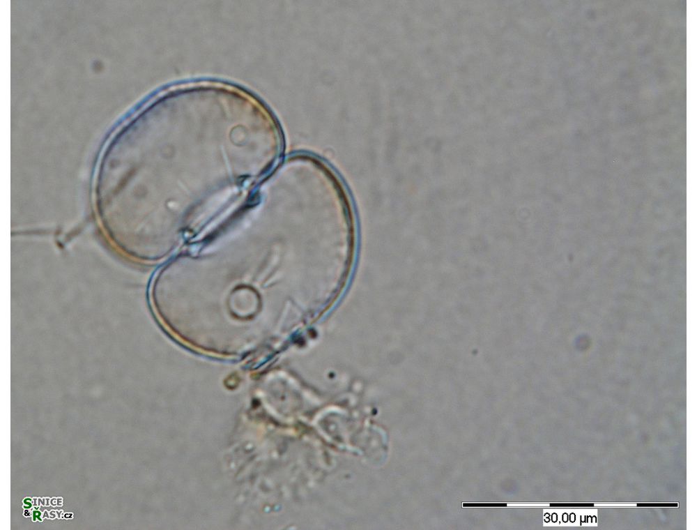 Cosmarium subtumidum