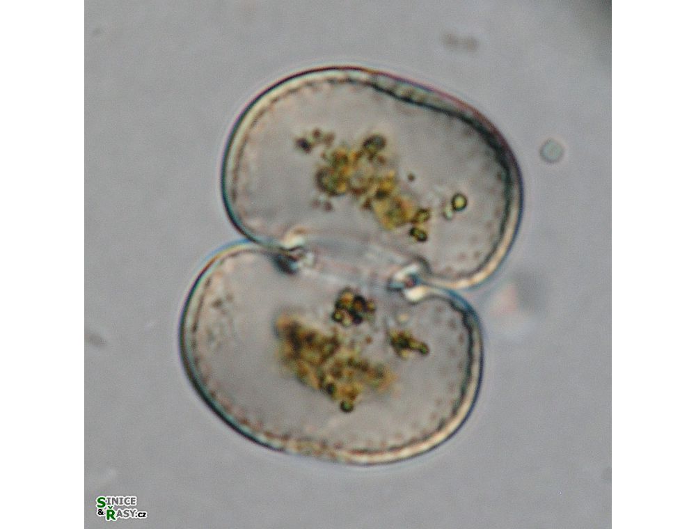 Cosmarium subtumidum