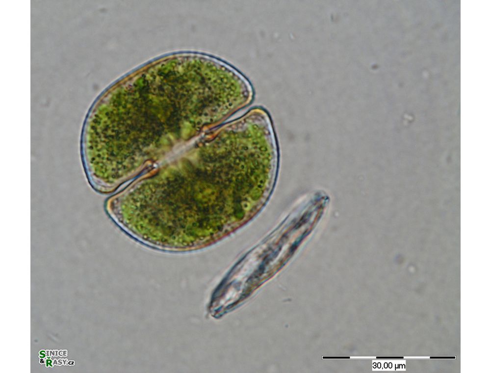 Cosmarium taxichondriforme