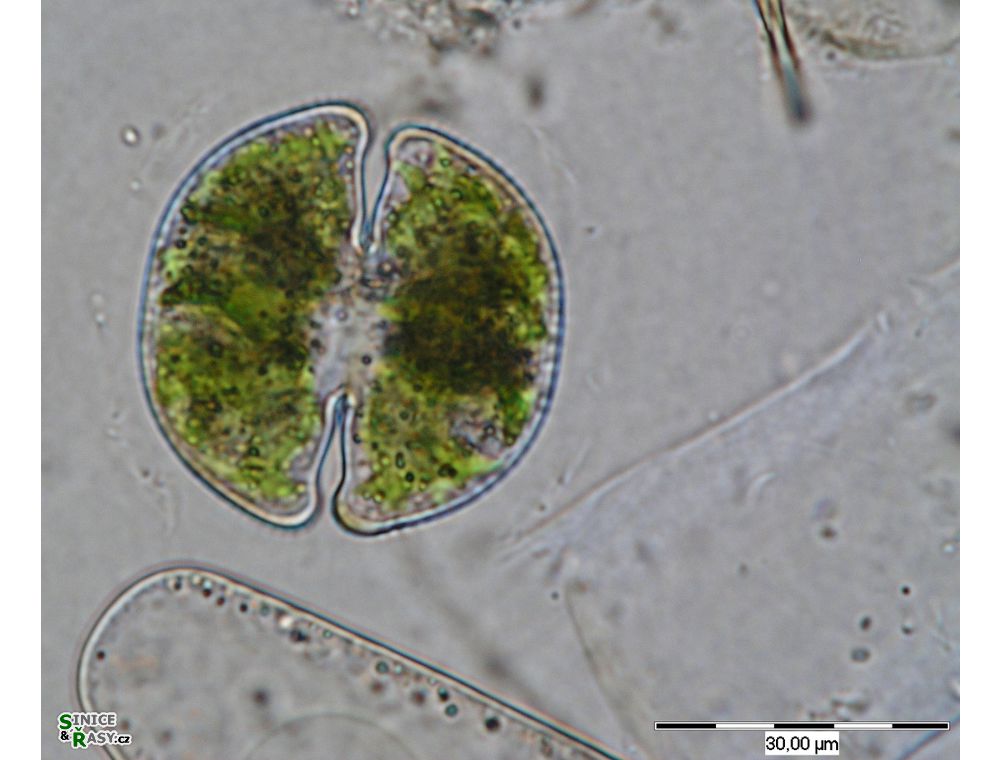 Cosmarium taxichondriforme