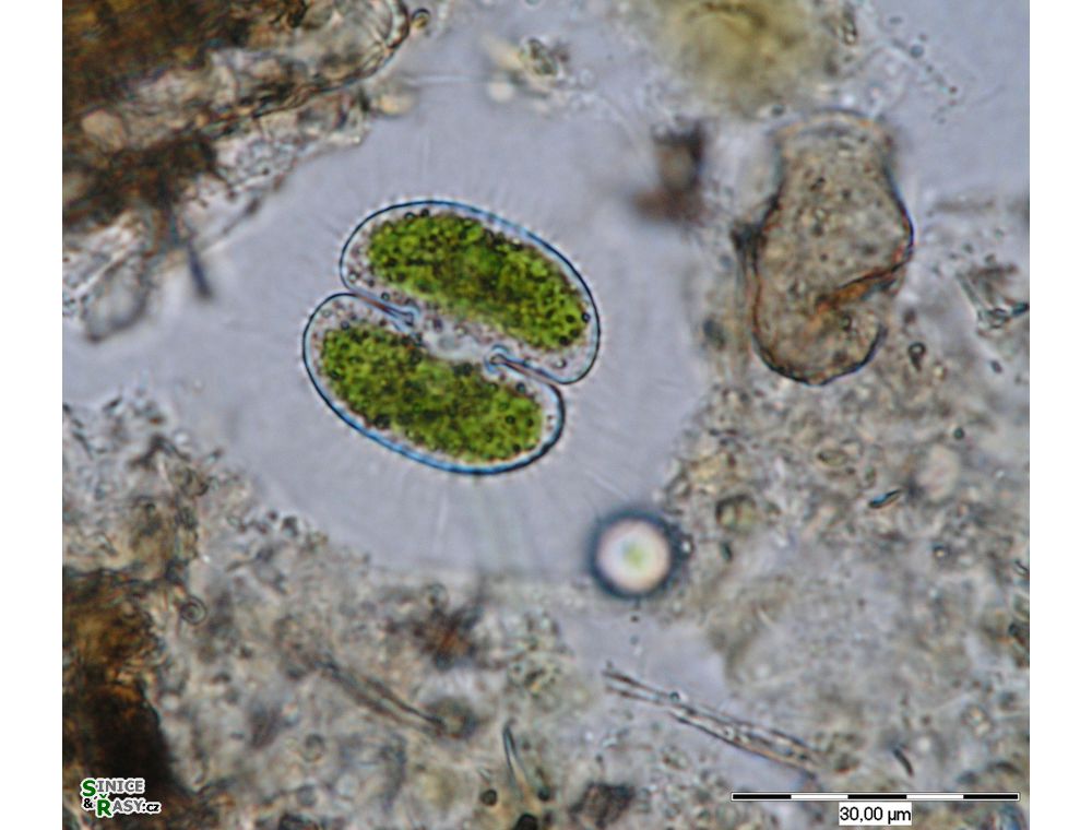 Cosmarium tetrachondrum