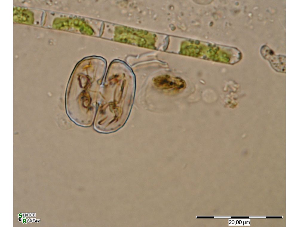 Cosmarium tetrachondrum