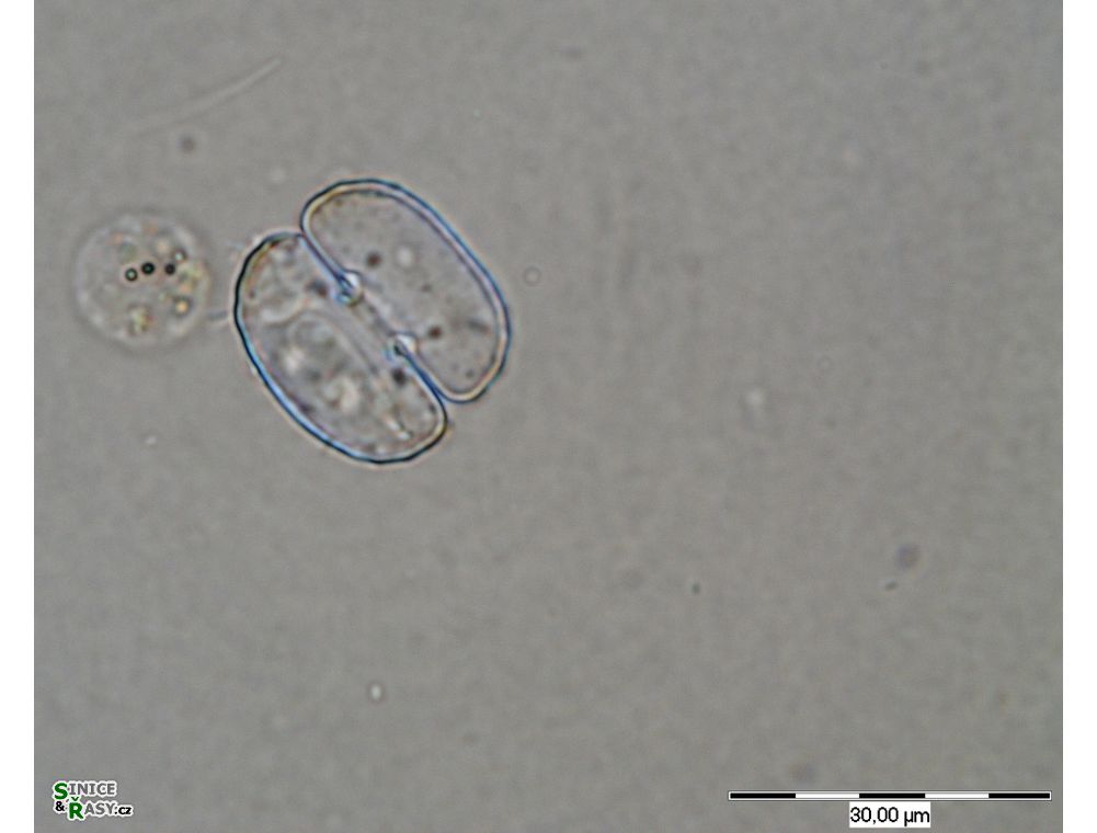 Cosmarium tetrachondrum