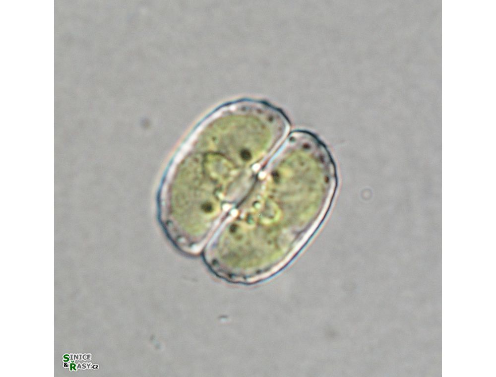 Cosmarium tetrachondrum