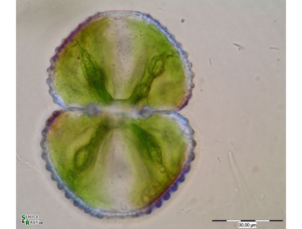 Cosmarium tetraophtalmum
