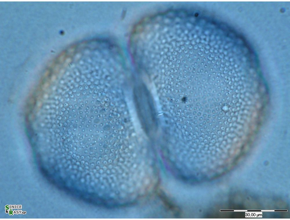 Cosmarium tetraophtalmum