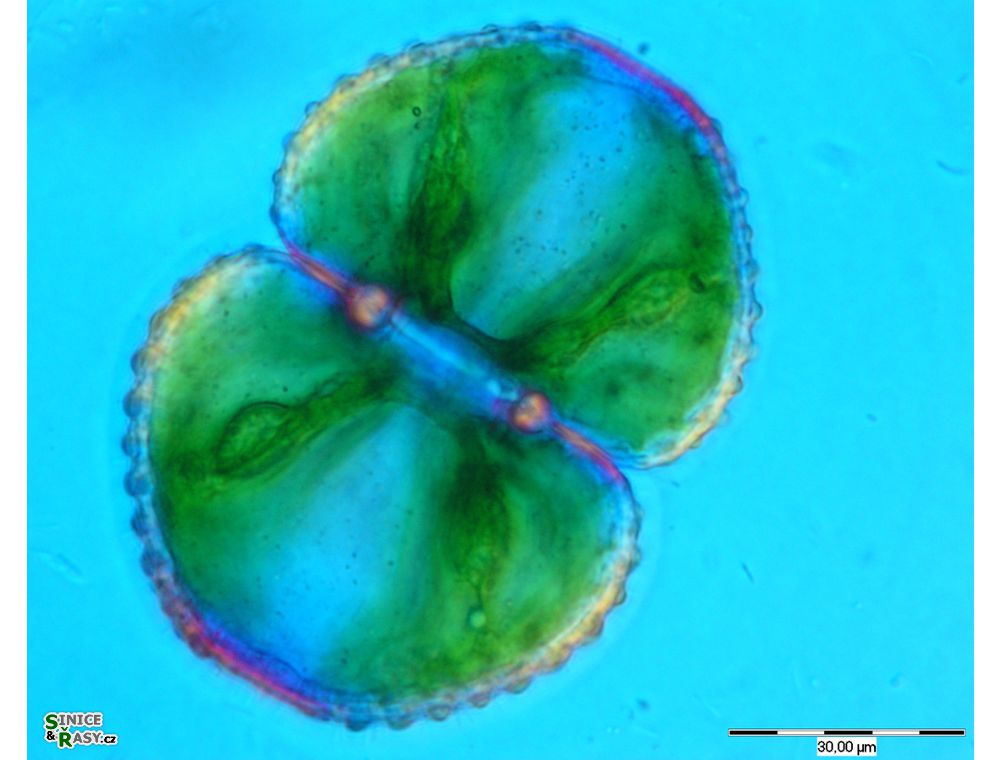 Cosmarium tetraophtalmum