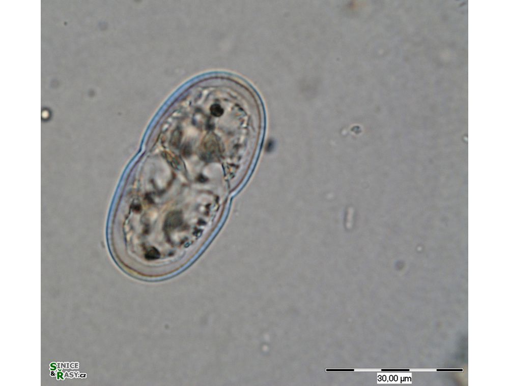 Cosmarium thwaitesii