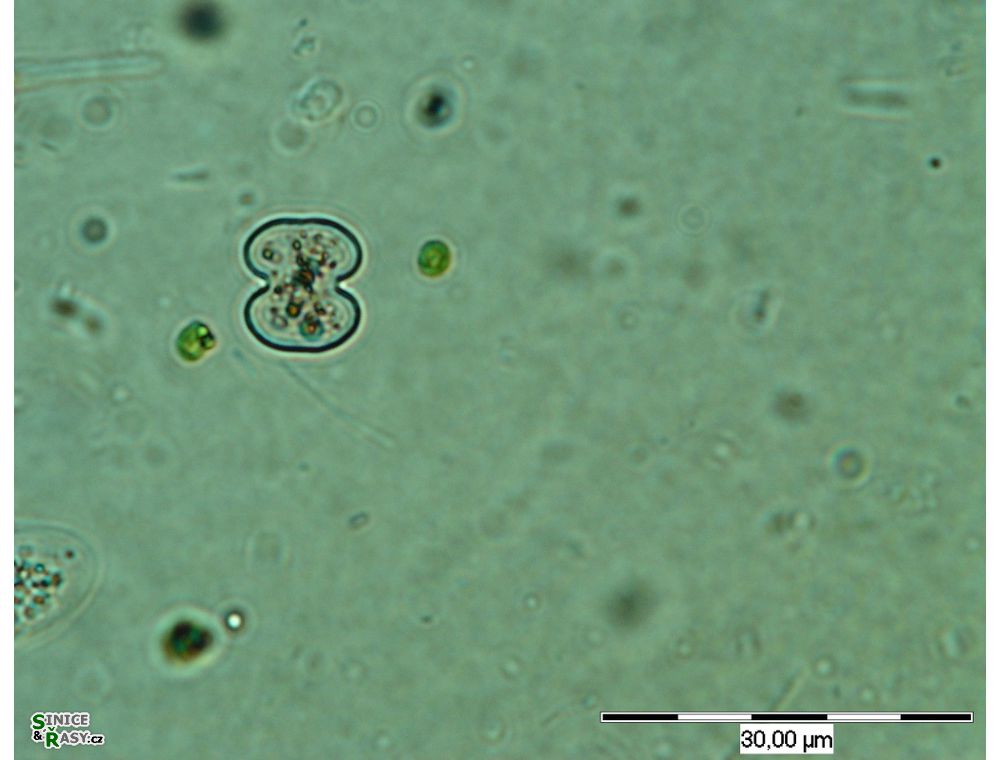 Cosmarium tinctum