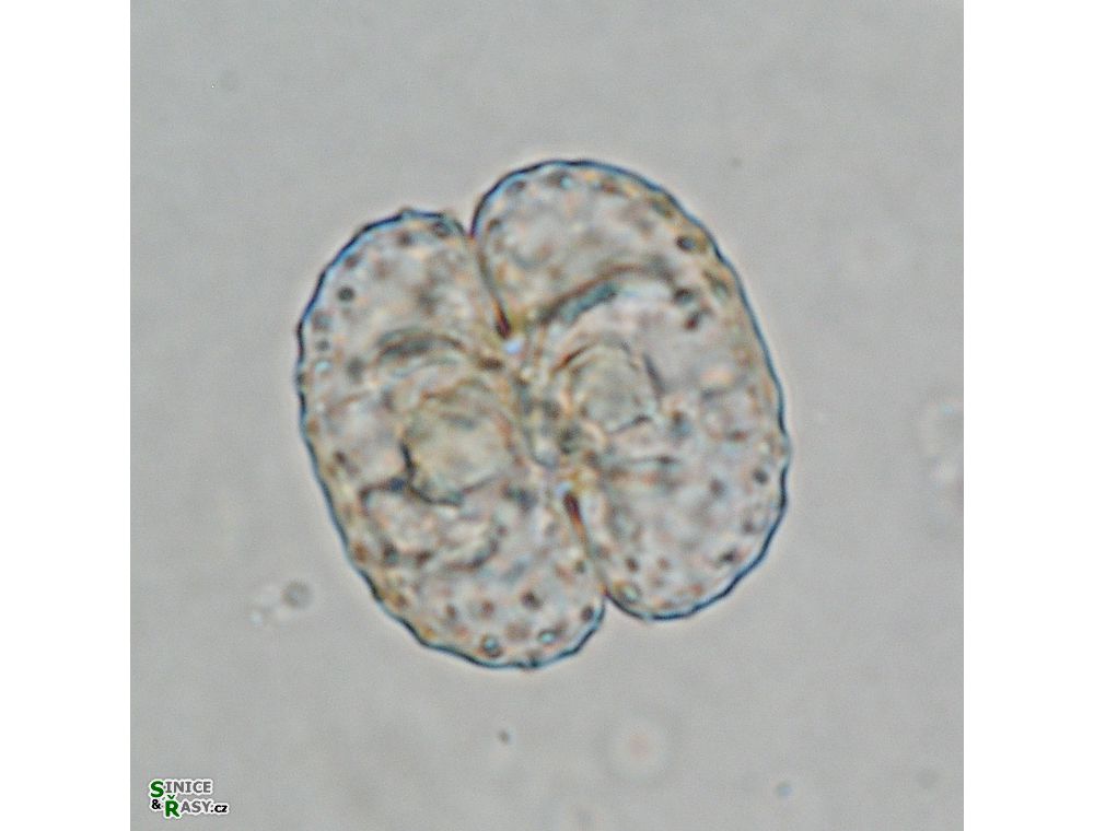 Cosmarium trachypleurum