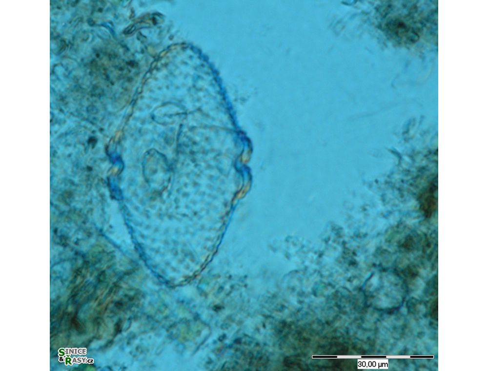 Cosmarium turpinii