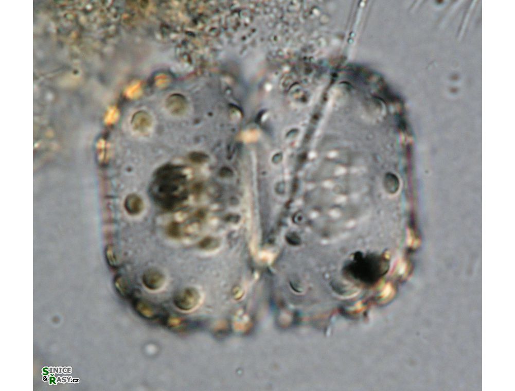 Cosmarium ungerianum