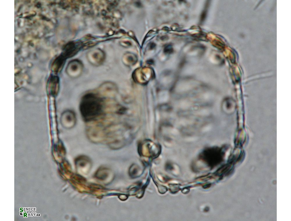 Cosmarium ungerianum