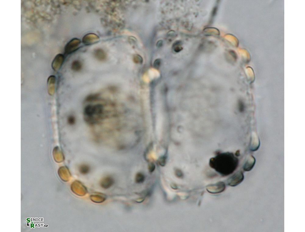 Cosmarium ungerianum