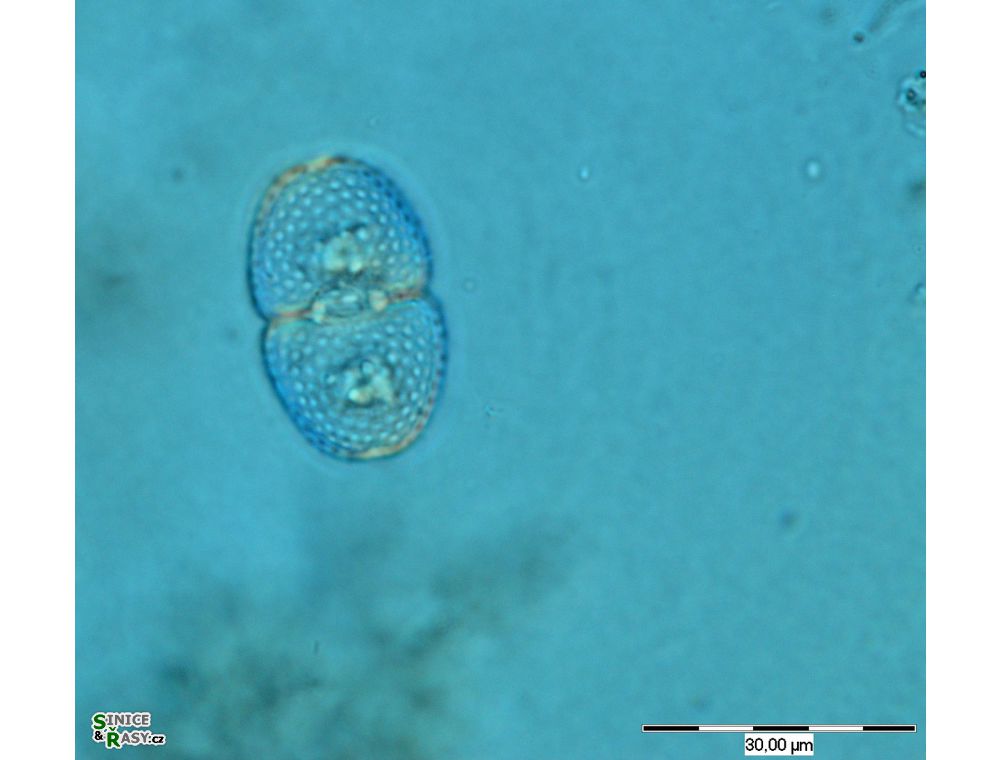 Cosmarium variolatum