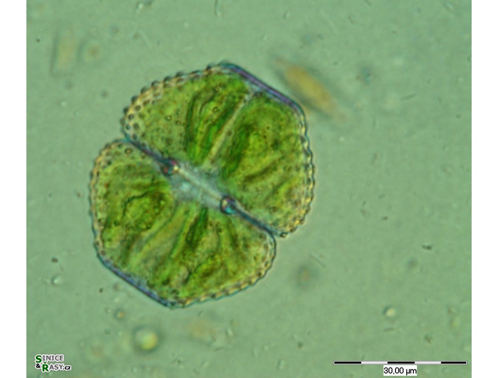 Cosmarium vexatum