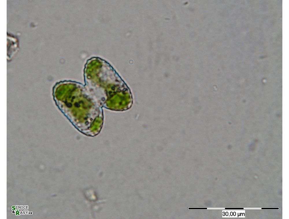 Cosmarium wittrockii