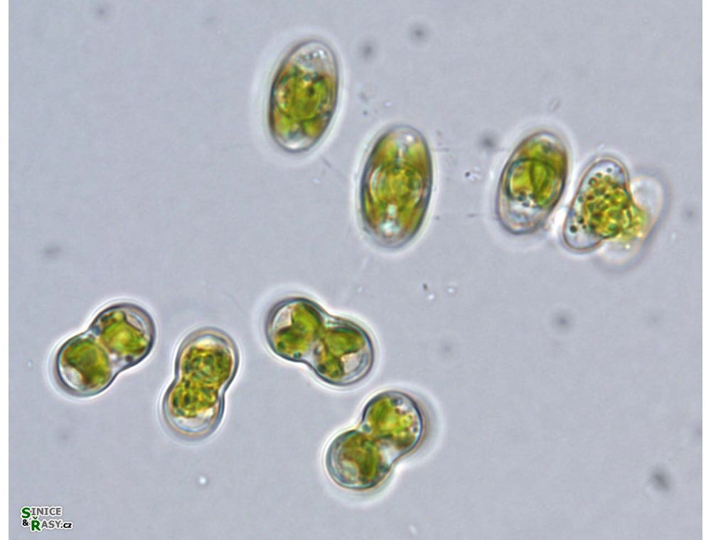 Cosmocladium perissum