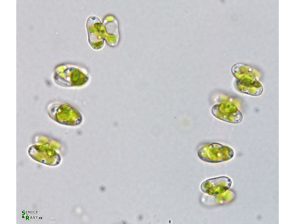 Cosmocladium perissum